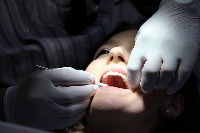 Quanto durano le faccette per i denti?